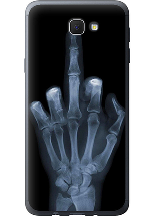 Чохол на samsung galaxy j5 prime рука через рентген "1007u-465-851"
