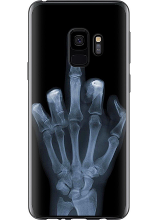 Чохол на samsung galaxy s9 рука через рентген "1007u-1355-851"
