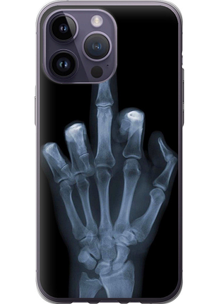 Чохол на iphone 14 pro max рука через рентген "1007u-2667-851"