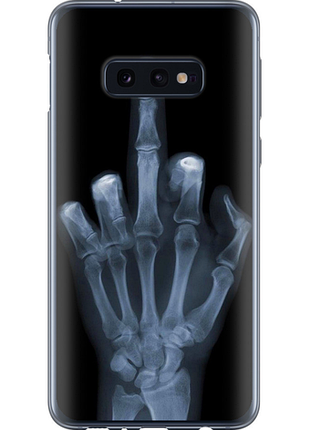 Чохол на samsung galaxy s10e рука через рентген "1007u-1646-851"