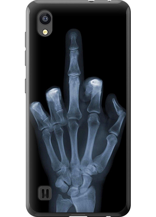 Чохол на zte blade a5 2019 рука через рентген "1007u-2109-851"
