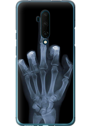 Чохол на oneplus 7t pro рука через рентген "1007u-1810-851"