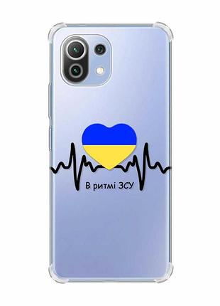 Чохол з потовщеними кутами на xiaomi mi 11 lite :: в ритмі зсу (патріотичний принт 70)