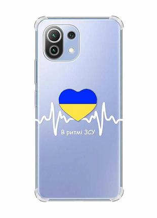 Чохол з потовщеними кутами на xiaomi mi 11 lite :: в ритмі зсу (патріотичний принт 71)