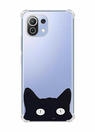 Чохол з потовщеними кутами на xiaomi mi 11 lite :: котик (принт 119)