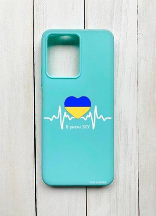 Матовий бірюзовий чохол на xiaomi redmi note 12 в ритмі зсу (принт 71)