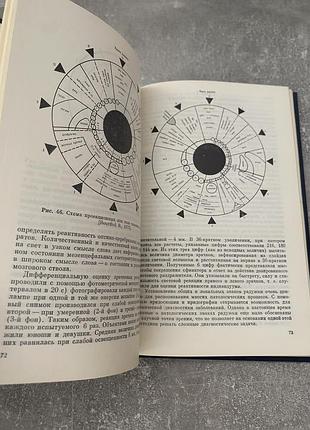 Иридодиагностика 8