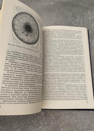 Иридодиагностика 5