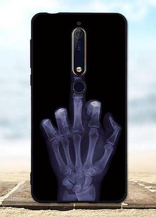 Оригінальний чохол накладка для nokia 6 2018 з картинкою рентген