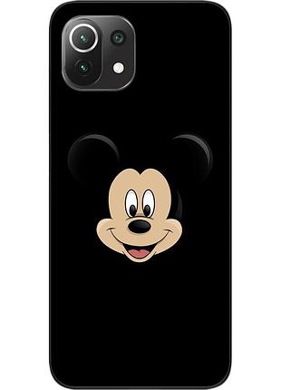 Силиконовый чехол для xiaomi mi 11 lite с картинкой микки