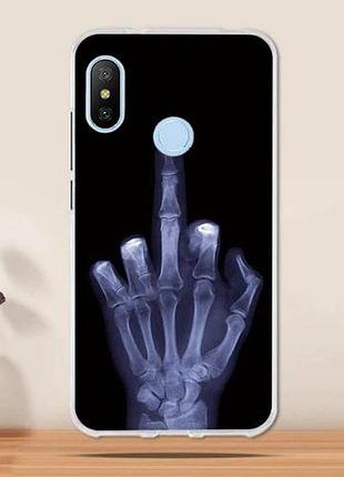 Оригінальний чохол панель накладка для xiaomi mi a2 / mi 6x з картинкою рентген