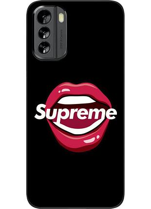 Оригинальный чехол epik для nokia g60 с картинкой губы
