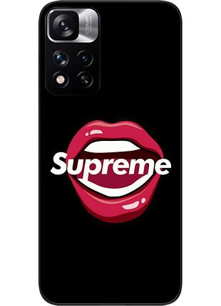 Оригинальный чехол epik для xiaomi redmi note 11 pro plus 5g с картинкой губы