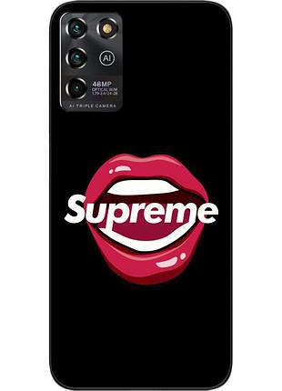 Силиконовый чехол для zte blade v30 vita с картинкой губы supreme