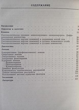 Хвороби бехтерєва 3