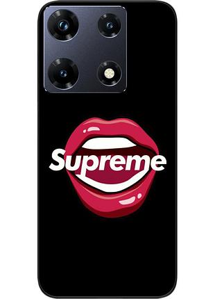 Силиконовый чехол epik для infinix note 30 pro 4g (x678b) с картинкой губы