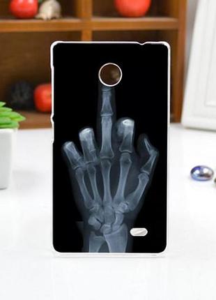 Чохол накладка для nokia x з принтом рентген