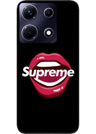 Силиконовый чехол epik для infinix note 30 4g (x6833b) с картинкой губы