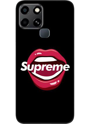 Оригінальний чохол epik для infinix smart 6 з картинкою губи