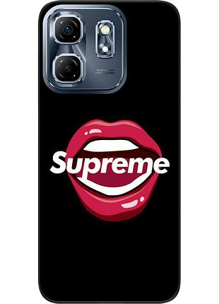 Силиконовый чехол epik для infinix hot 50i с картинкой губы