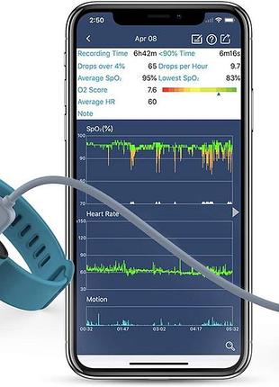Viatom монитор насыщения крови кислородом на запястье, перезаряжаемый, bluetooth трекер сна, пульсоксиметр