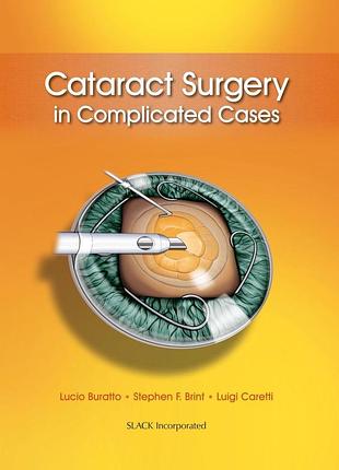 Cataract surgery in complicated cases. 2013. lucio buratto, stephen f. brint, luigi caretti.
