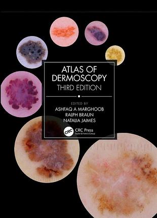Atlas of dermoscopy. 3rd ed. 2023. ashfaq a. marghoob, ralph braun, natalia jaimes.