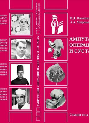 Ампутации. операции на костях и суставах. 3-е изд. 2014. иванова в.д., колсанов а.в., миронов а.а., яремин б.и.