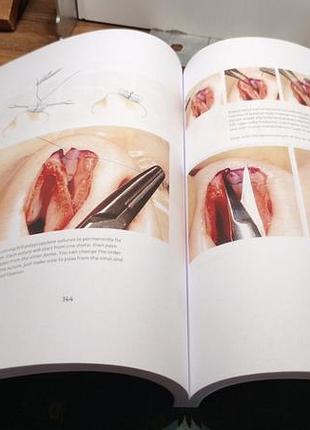 Teorhinoplasty. 2nd ed. 2024. teoman dogan. 2