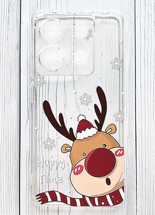 Прозорий чохол на xiaomi redmi 15c зимове оленя (принт 155)
