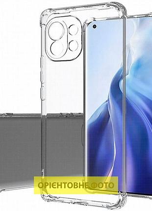 Tpu чехол getman ease logo усиленные углы full camera для xiaomi redmi 15 4g (global) / 5g бесцветный (прозрачный) 2
