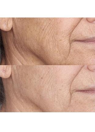 Крем для обличчя perricone md high potency face finishing & firming moisturizer broad spectrum spf 30 5 мл на розпив 3