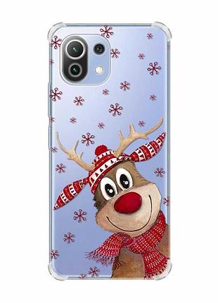Чохол з потовщеними кутами на xiaomi mi 11 lite зимове оленятко (принт 149)