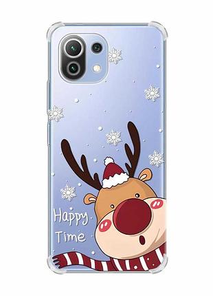 Чехол с утолщёнными углами на xiaomi mi 11 lite :: зимний оленёнок (принт 155)