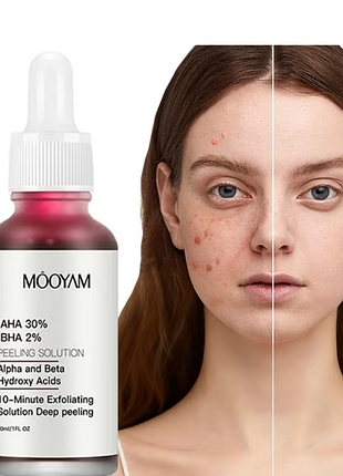 Кровавий пілінг для обличчя mooyam кислотний пілінг-сироватка aha 30% + bha 2% solution 30 мл