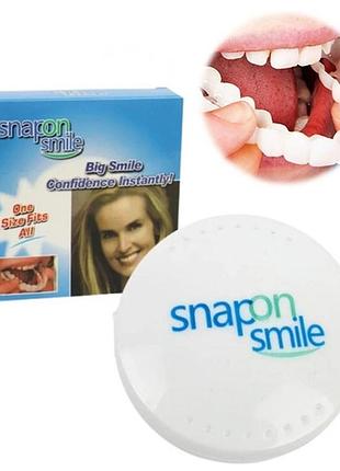 Вініри для зубів верх snap on smile