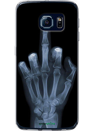 Чохол на samsung galaxy s6 edge g925f рука через рентген "1007u-83-72104"