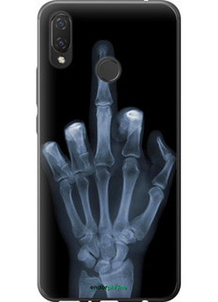Чехол на huawei p smart plus рука через рентген "1007u-1555-72104"