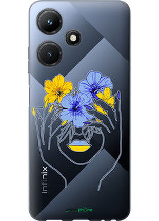 Чехол на infinix hot 30i девушка v4 "5276u-3045-72104"