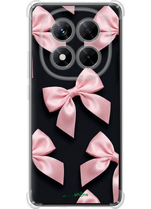 Чехол на xiaomi redmi note 14 pro+ 5g coquette ribbons dark coquette "6767sp-3885-72104"