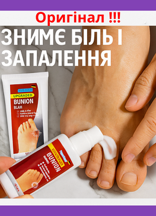 Ефективний бальзам для видалення мозолів, бородавок від вальгусної деформації sumitun bunion 100ml