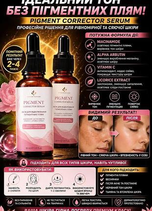 Сироватка від пігментних плям освітлювальна для обличчя pigment corrector serum 30 мл флакон з дозатором