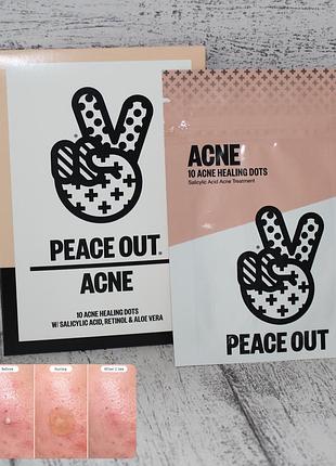 Peace out salicylic acid & hydrocolloid acne treatment pimple patches гідроколоїдні патчі проти акне