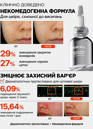 Сироватка для обличчя purcell pixcell biom 2 billion/ml зміцнювальна 30 ml 2