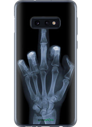 Чохол на samsung galaxy s10e рука через рентген "1007u-1646-72104"