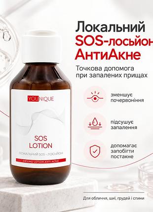 Лосьйон sos для проблемної шкіри бовтушка проти акне та прищів jerelia антиакне 50 мл