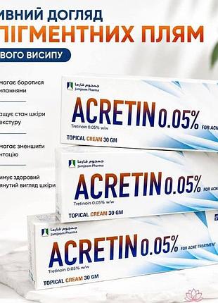 *acret*, *акретін;*