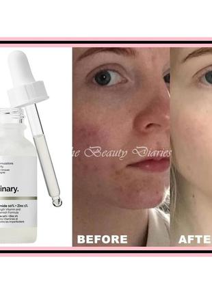 Сыворотка для идеальной кожи the ordinary niacinamide 10% + zinc 1% ниацинамид и цинк