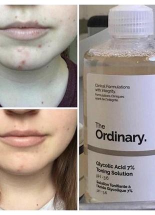 Обновляющий тоник с гликолевой кислотой the ordinary - glycolic acid 7% toning solution3 фото