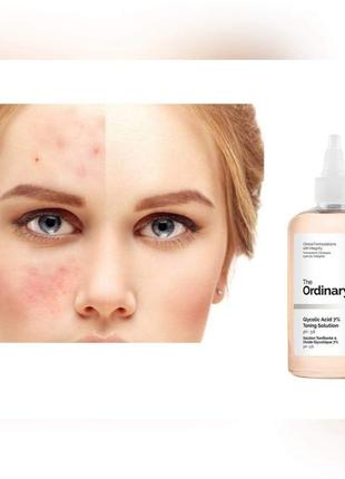 Обновляющий тоник с гликолевой кислотой the ordinary - glycolic acid 7% toning solution